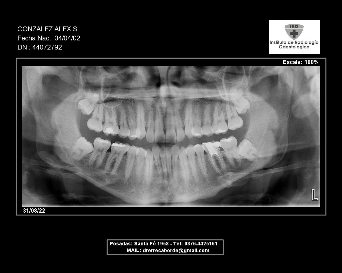 Caso clínico - radiografía panorámica